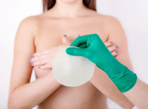 Breast Augmentation Guide: What to Know Before You Decide
